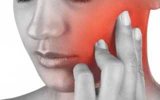 Болит голова и челюсть слева
