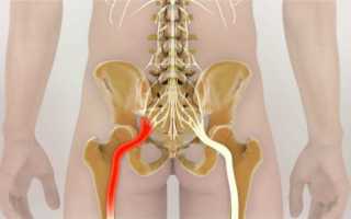 Болит в конце спины