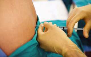 После спинномозговой анестезии болит спина что делать в домашних условиях