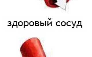 Болит голова расширить сосуды