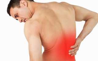 Что делать если болит спина растяжение