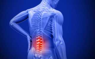 Болит спина больно наступать на ногу