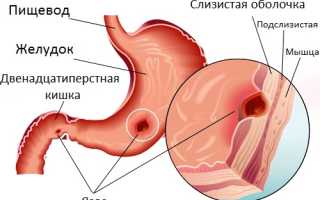 Болит спина и живот что это означает