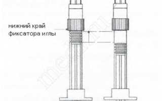 Холодный пот болит в спине