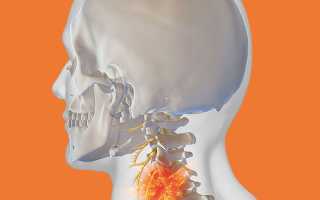 Если болит спина шея и голова