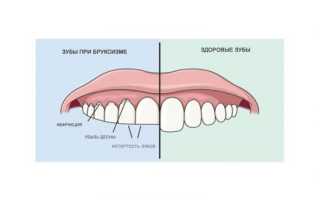Болит челюсть слева отдает в голову