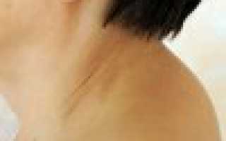 Болит горб на спине что делать