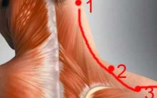 К какому врачу идти если болит голова и шея
