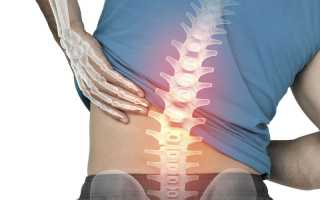 Болит спина внизу когда долго стоишь