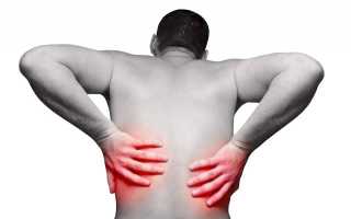 Почему болит спина повыше поясницы по бокам