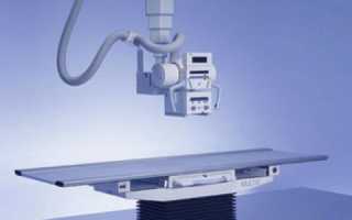 Болит спина на рентгене норма