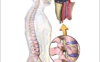 Что такое болит в правой стороне спины