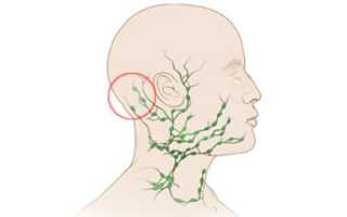 Болит голова воспалились лимфоузлы на шее