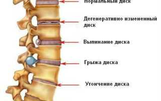Если спина болит и внутри горит