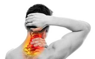 При защемлении нерва в шейном отделе болит голова