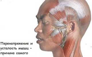 Голова болит когда напрягаюсь