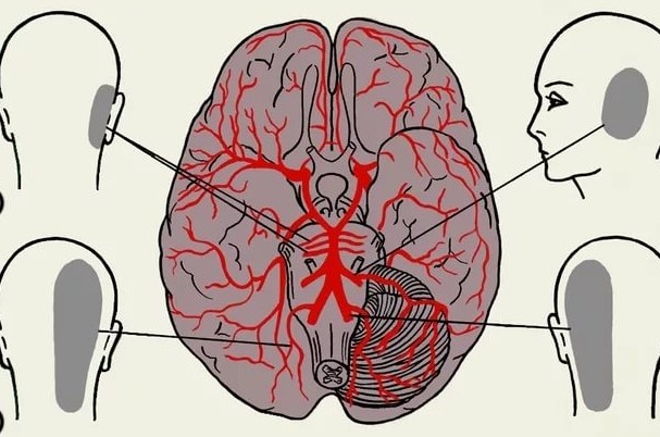 Болит только левая часть головы отдает в затылок