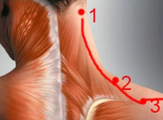 К какому врачу идти если болит голова и шея