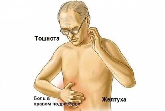 боли в подреберье