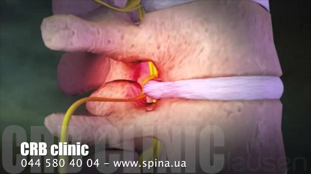 Болит в конце спины