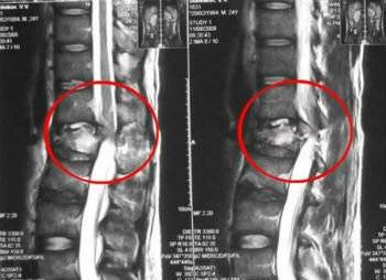 Наклоняю голову вперед болит спина что это