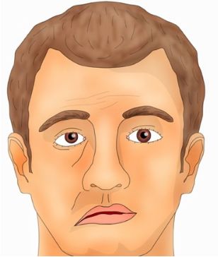 при движении сильно болит голова