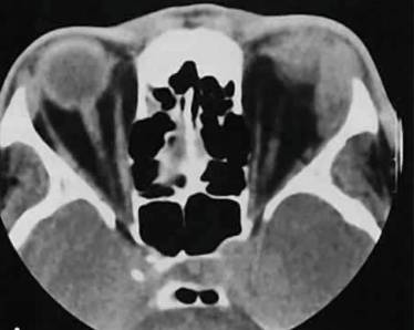 болит вся спина и температура 37