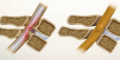 От чего болит спина и боль отдает в пах