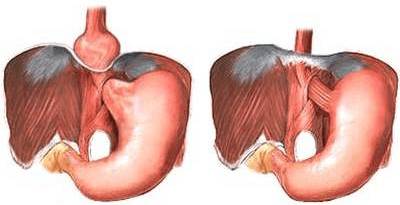 У девочки болит спина с левой стороны
