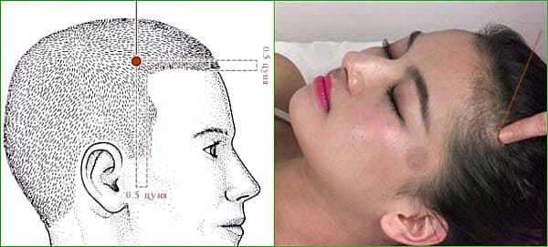 Точка Тоу-вэй