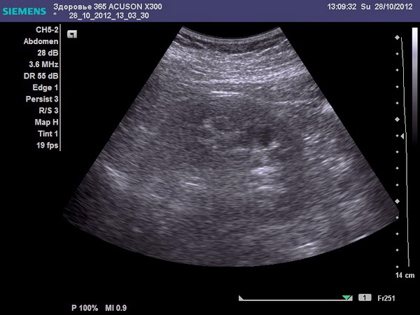 Ультразвуковое исследование