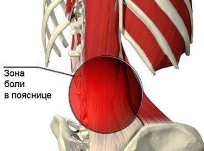 Очень болит спина на втором месяце беременности
