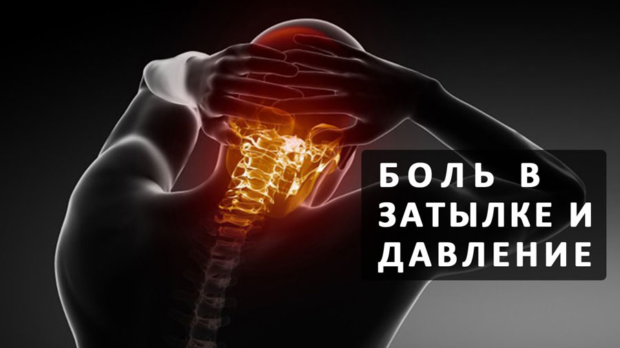 Лекарства если болит затылочная часть головы