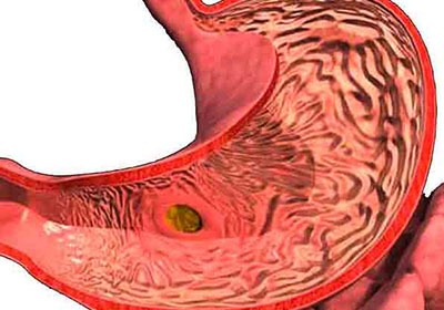 У девочки болит спина с левой стороны