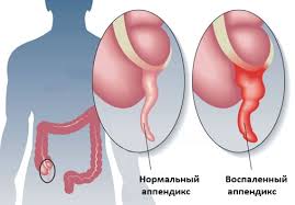 Болит справа спина на уровне талии