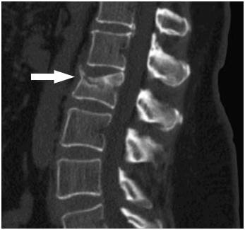 Болит справа спина на уровне талии
