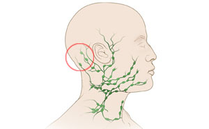 Лимфоузлы на затылке