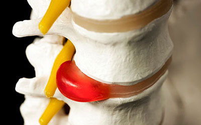 От чего болит спина и боль отдает в пах