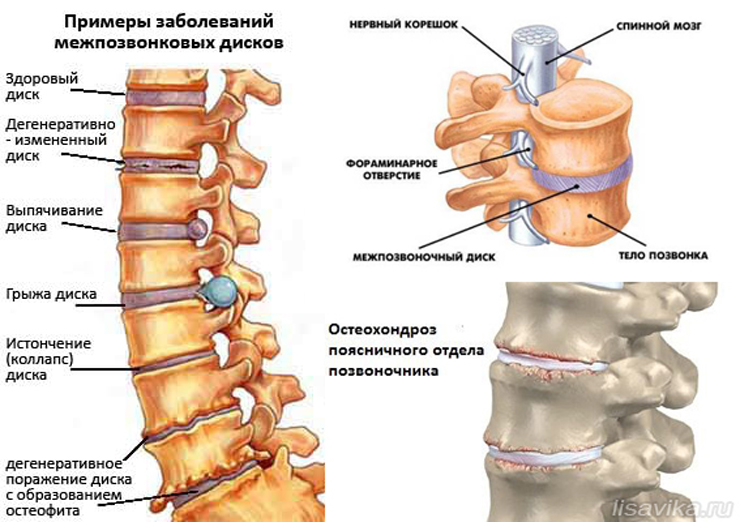 показания к использованию