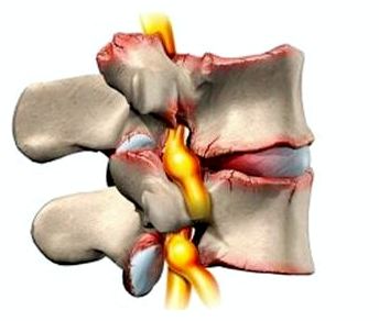 У девочки болит спина с левой стороны