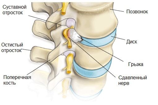 Болит справа спина на уровне талии