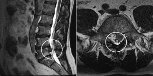 Крестцовый отдел позвоночника