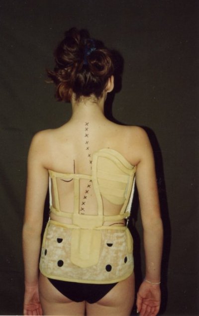 Корсет Шено