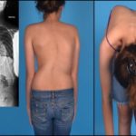 При сильно вдохе болит спина и грудь