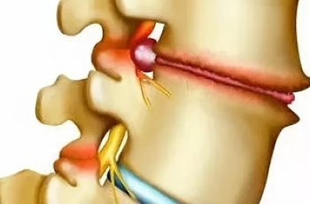 Наклоняю голову вперед болит спина что это