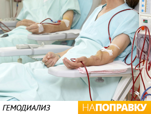 гемодиализ, ХПН, почечная недостаточность Сеанс гемодиализа