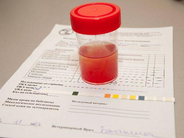 Повышенные эритроциты в моче у ребенка