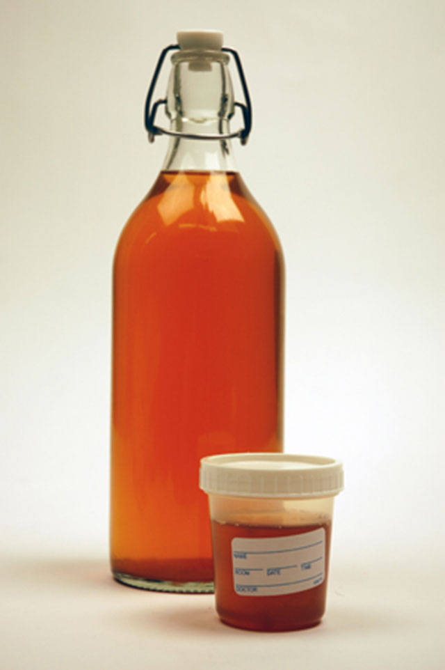 Моча красного и красноватого цвета у мужчин